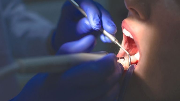 A realidade do atendimento odontológico em São Paulo e os caminhos para ampliar o acesso à saúde bucal