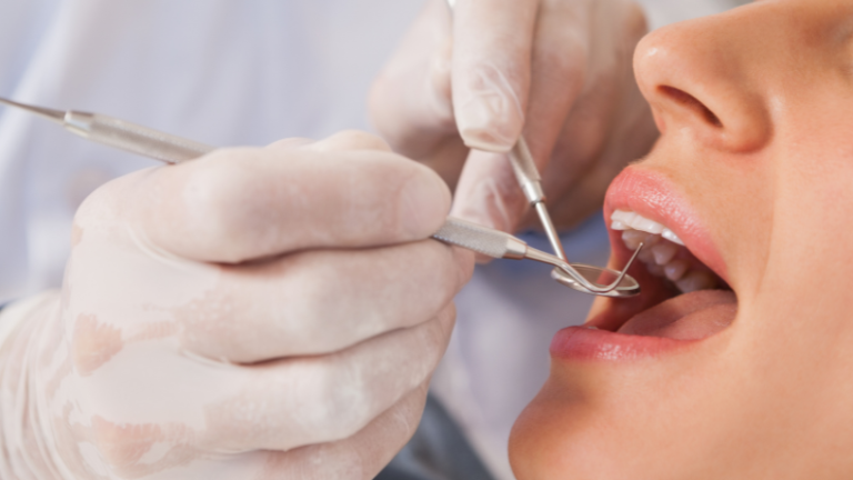 Dentista esquece broca na boca de paciente e gera indenização: o que o caso revela sobre erros odontológicos no Brasil Dentista esquece broca na boca de paciente e gera indenização: o que o caso revela sobre erros odontológicos no Brasil