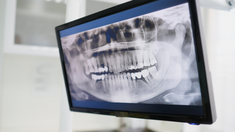 Impressão 3D na odontologia ganha espaço e muda a rotina dos consultórios brasileiros