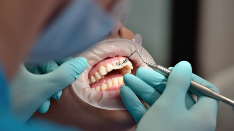 Novas regras e dados da Odontologia colocam carreira, segurança e acesso à saúde bucal no centro das atenções no Brasil Novas regras e dados da Odontologia colocam carreira, segurança e acesso à saúde bucal no centro das atenções no Brasil